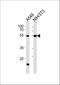 T-Box 4 antibody, A06607, Boster Biological Technology, Western Blot image 