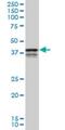 Poly(RC) Binding Protein 2 antibody, H00005094-M04, Novus Biologicals, Western Blot image 
