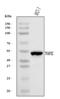 Transcription Factor AP-2 Gamma antibody, A01558-2, Boster Biological Technology, Western Blot image 