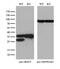 Serine And Arginine Rich Splicing Factor 9 antibody, M05860, Boster Biological Technology, Western Blot image 
