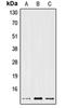 Trefoil Factor 1 antibody, orb214657, Biorbyt, Western Blot image 