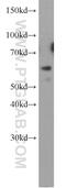 Hyaluronidase 2 antibody, 15115-1-AP, Proteintech Group, Western Blot image 