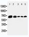 Paxillin antibody, PA5-79899, Invitrogen Antibodies, Western Blot image 