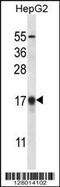 Microtubule Associated Protein 1 Light Chain 3 Beta antibody, MBS9201154, MyBioSource, Western Blot image 