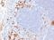 Immunoglobulin Kappa Variable 1D-16 antibody, NBP2-45086, Novus Biologicals, Immunohistochemistry paraffin image 