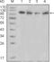 Protein Tyrosine Kinase 2 Beta antibody, abx016050, Abbexa, Enzyme Linked Immunosorbent Assay image 