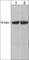 Raf-1 Proto-Oncogene, Serine/Threonine Kinase antibody, RM2081, ECM Biosciences, Western Blot image 