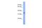 Melanoma-associated antigen 2 antibody, PA5-45044, Invitrogen Antibodies, Western Blot image 