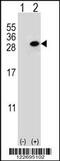 Clathrin Light Chain A antibody, 63-742, ProSci, Western Blot image 