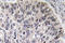 Carbonic Anhydrase 2 antibody, LS-C291678, Lifespan Biosciences, Immunohistochemistry paraffin image 