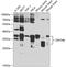 Zinc Finger Protein 346 antibody, GTX65857, GeneTex, Western Blot image 