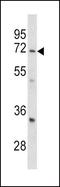 Leucine Rich Repeat Containing 32 antibody, GTX81794, GeneTex, Western Blot image 