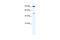 Zinc Finger Protein 175 antibody, 28-369, ProSci, Enzyme Linked Immunosorbent Assay image 