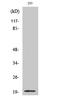 Stathmin 3 antibody, STJ95821, St John