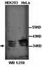 STIP1 Homology And U-Box Containing Protein 1 antibody, orb77249, Biorbyt, Western Blot image 