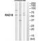 RAD18 E3 Ubiquitin Protein Ligase antibody, PA5-50025, Invitrogen Antibodies, Western Blot image 