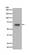 Ribosomal Protein S6 Kinase B1 antibody, M01475-1, Boster Biological Technology, Western Blot image 