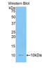 Interleukin 6 Receptor antibody, LS-C302781, Lifespan Biosciences, Western Blot image 