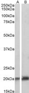 Caveolin 3 antibody, 46-992, ProSci, Enzyme Linked Immunosorbent Assay image 