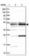 Tetratricopeptide Repeat Domain 4 antibody, PA5-59983, Invitrogen Antibodies, Western Blot image 