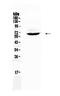 Heparanase antibody, PA5-79394, Invitrogen Antibodies, Western Blot image 