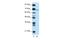 Zinc Finger And BTB Domain Containing 22 antibody, A13428, Boster Biological Technology, Western Blot image 