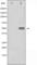 Glycogen Synthase Kinase 3 Alpha antibody, abx010868, Abbexa, Western Blot image 