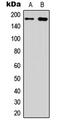 EGFR antibody, LS-B16092, Lifespan Biosciences, Western Blot image 