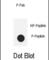 NPHS1 Adhesion Molecule, Nephrin antibody, abx032102, Abbexa, Western Blot image 