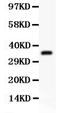 Follicle Stimulating Hormone Subunit Beta antibody, LS-C343969, Lifespan Biosciences, Western Blot image 