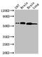 Dihydropyrimidinase Like 2 antibody, LS-C672411, Lifespan Biosciences, Western Blot image 