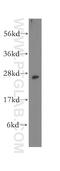 Zinc Ribbon Domain Containing 2 antibody, 12273-1-AP, Proteintech Group, Western Blot image 