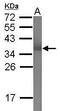 Tripartite Motif Containing 62 antibody, GTX117715, GeneTex, Western Blot image 
