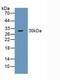 Sodium Channel Epithelial 1 Alpha Subunit antibody, abx130996, Abbexa, Western Blot image 