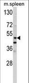 Matrix Metallopeptidase 10 antibody, LS-C100440, Lifespan Biosciences, Western Blot image 