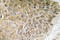 Phosphoinositide-3-Kinase Regulatory Subunit 1 antibody, LS-C286279, Lifespan Biosciences, Immunohistochemistry paraffin image 
