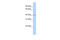 Heterogeneous Nuclear Ribonucleoprotein D Like antibody, 25-629, ProSci, Enzyme Linked Immunosorbent Assay image 