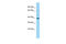 Indoleamine 2,3-dioxygenase 2 antibody, ARP64734_P050, Aviva Systems Biology, Western Blot image 