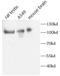 Adaptor Related Protein Complex 2 Subunit Beta 1 antibody, FNab00462, FineTest, Western Blot image 