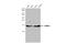 Mitochondrial import receptor subunit TOM20 homolog antibody, GTX133756, GeneTex, Western Blot image 
