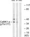 Calcium/calmodulin-dependent protein kinase type 1 antibody, PA5-38434, Invitrogen Antibodies, Western Blot image 