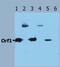 Transposase for insertion sequence element IS1106 antibody, PA1-19444, Invitrogen Antibodies, Western Blot image 