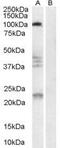 Reticulon 4 Receptor antibody, GTX89548, GeneTex, Western Blot image 