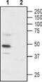 Purinergic Receptor P2X 3 antibody, TA329005, Origene, Western Blot image 