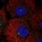Large Tumor Suppressor Kinase 2 antibody, HPA049037, Atlas Antibodies, Immunocytochemistry image 