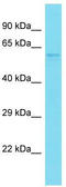 NudC Domain Containing 1 antibody, TA346650, Origene, Western Blot image 