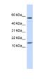 Keratin Associated Protein 11-1 antibody, orb325242, Biorbyt, Western Blot image 