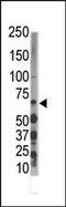 Dual Specificity Tyrosine Phosphorylation Regulated Kinase 3 antibody, PA5-14464, Invitrogen Antibodies, Western Blot image 