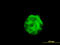 Sarcoglycan Beta antibody, LS-B4415, Lifespan Biosciences, Immunofluorescence image 