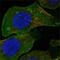 Discoidin Domain Receptor Tyrosine Kinase 2 antibody, MA5-15356, Invitrogen Antibodies, Immunofluorescence image 